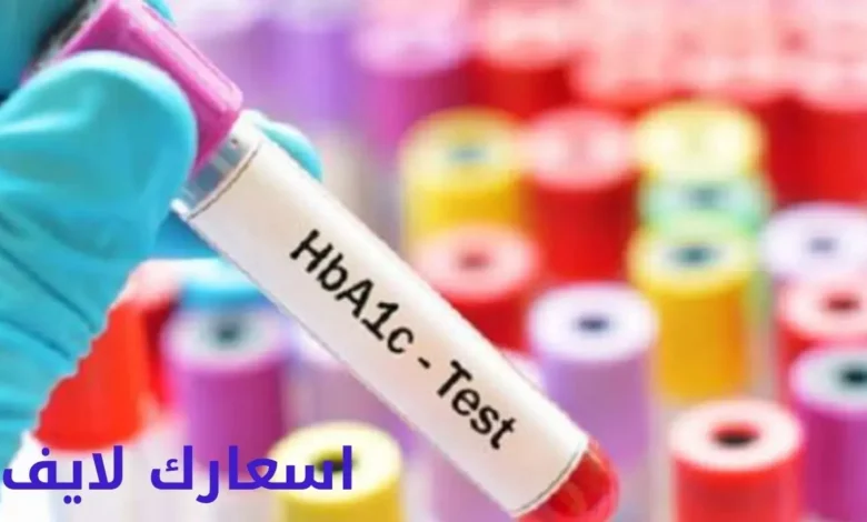 سعر تحليل السكر التراكمي في السعودية