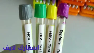 سعر تحليل مزرعة البول في السعودية