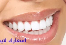 سعر ابتسامة هوليود في السعودية