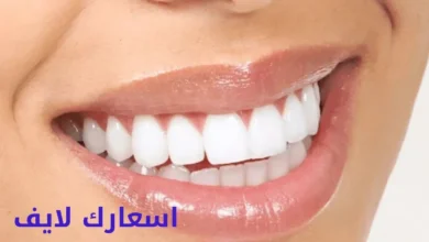 سعر ابتسامة هوليود في السعودية