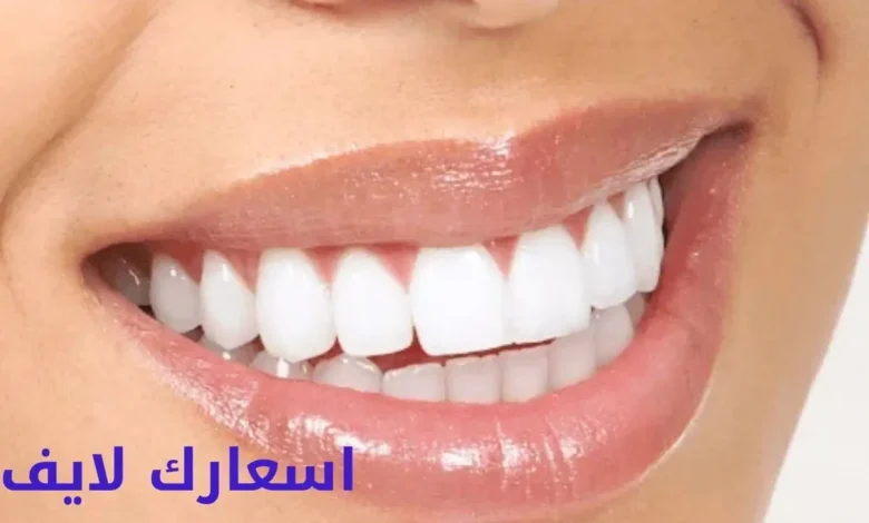 سعر ابتسامة هوليود في السعودية