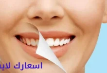 أسعار وعروض ابتسامة هوليود في مصر