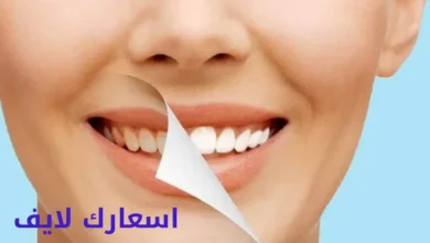 أسعار وعروض ابتسامة هوليود في مصر