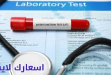 أسعار تحاليل وظائف وإنزيمات الكبد