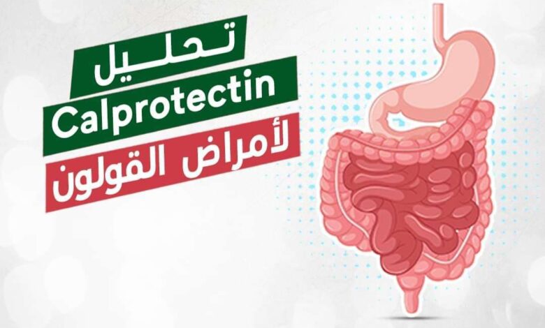 سعر تحليل الكالبيروكتين في معمل البرج 2025