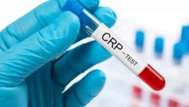 سعر تحليلCRP في معامل مصر 2025