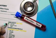 سعر تحليل Serum Ferritin في معمل البرج و ألفا 2025