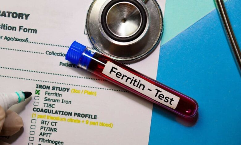 سعر تحليل Serum Ferritin في معمل البرج و ألفا 2025