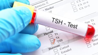 سعر تحليل الغدة الدرقية TSH في مصر 2025