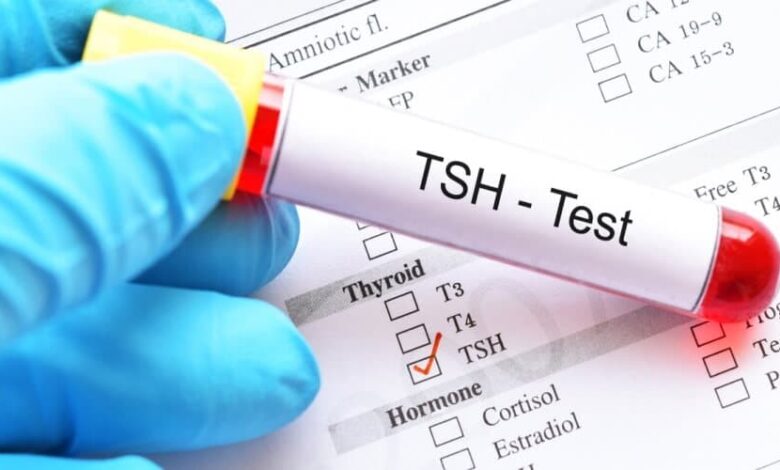 سعر تحليل الغدة الدرقية TSH في مصر 2025